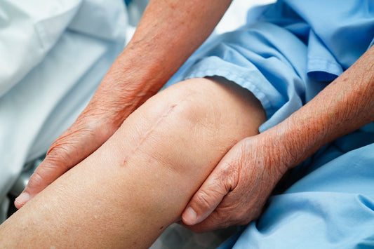 Why Proper Footwear Matters After Knee Surgery